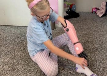 How one girl’s bionic arm sparked a movement