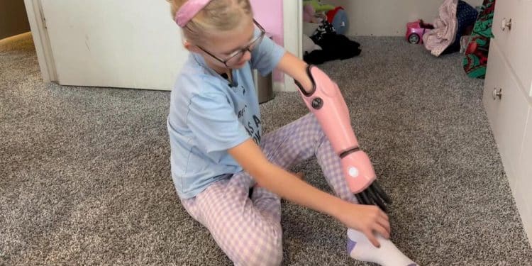 How one girl’s bionic arm sparked a movement
