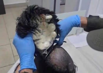 Man tried to smuggle bags of cocaine under “narco wig,” Colombian police say