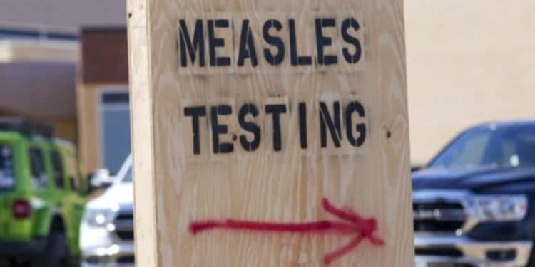Texas reports first death in Measles outbreak