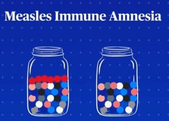 Doctor explains how the measles virus affects the immune system