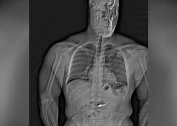 Thief allegedly swallows $700k in jewelry