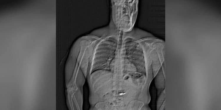 Thief allegedly swallows $700k in jewelry